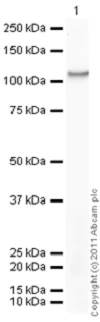 Western blot - Recombinant human PKC beta 1 protein (AB60840)