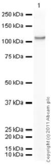 Western blot - Recombinant human PKC beta 1 protein (GST tag N-Terminus) (AB60840)