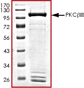SDS-PAGE - Recombinant human PKC beta 2 protein (AB60841)