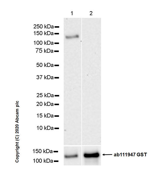 Western blot - Recombinant human PKC delta protein (AB60844), expandable thumbnail