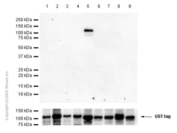 Western blot - Recombinant human PKC delta protein (AB60844)