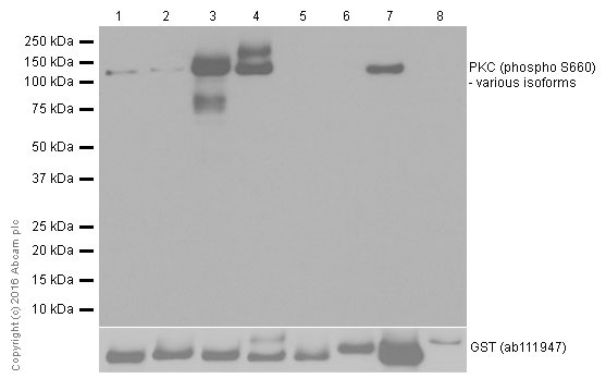 Western blot - Recombinant human PKC delta protein (GST tag N-Terminus) (AB60844)