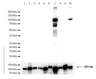 Western blot - Recombinant human PKC delta protein (GST tag N-Terminus) (AB60844)