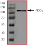 SDS-PAGE - Recombinant human PKC epsilon protein (AB60847)