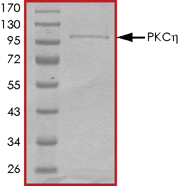 SDS-PAGE - Recombinant human PKC eta protein (AB60849)