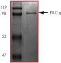 SDS-PAGE - Recombinant human PKC eta protein (AB60849)