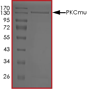 SDS-PAGE - Recombinant human PKC mu/PKD protein (AB60873)