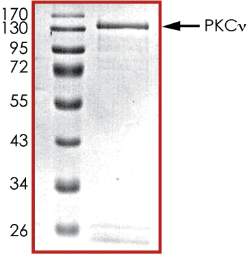 SDS-PAGE - Recombinant human PKC nu/PRKD3 protein (AB60874)