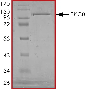 SDS-PAGE - Recombinant human PKC theta/PRKCQ protein (GST tag N-Terminus) (AB56641)
