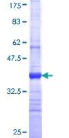 SDS-PAGE - Recombinant Human PKHD1L1 protein (GST tag N-Terminus) (AB164931)