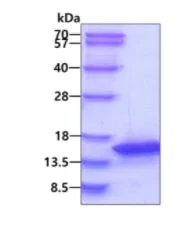 SDS-PAGE - Recombinant Human PKIB protein (His tag N-Terminus) (AB105619)