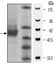 SDS-PAGE - Recombinant human PKLR protein (AB196100), expandable thumbnail