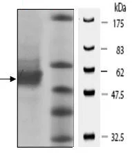 SDS-PAGE - Recombinant human PKLR protein (His tag N-Terminus) (AB196100)