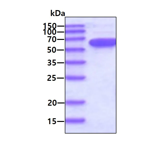 SDS-PAGE - Recombinant human PKM2 protein (Active) (His tag N-Terminus) (AB89364)