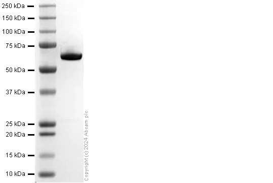SDS-PAGE - Recombinant human PKM2 protein (His tag) (AB318258)