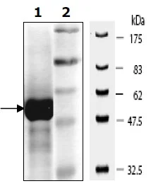SDS-PAGE - Recombinant human PKM2 protein (His tag N-Terminus) (AB196081)