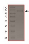 Recombinant human PKN1 protein