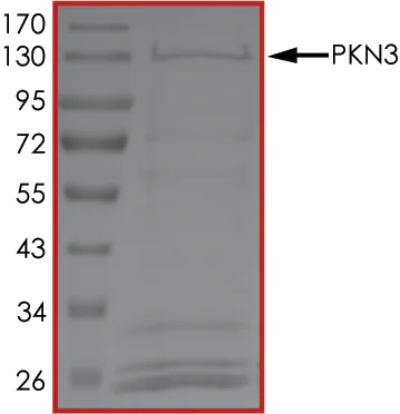 SDS-PAGE - Recombinant human PKN3 protein (AB125615)