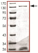 SDS-PAGE - Recombinant human PKN3 protein (AB125615)