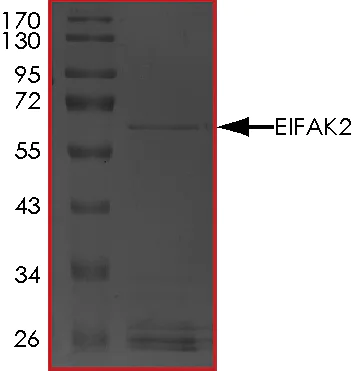 SDS-PAGE - Recombinant human PKR protein (AB85838)