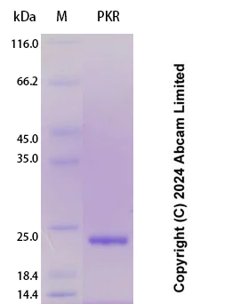 SDS-PAGE - Recombinant Human PKR Protein Standard (His tag) (AB323095)