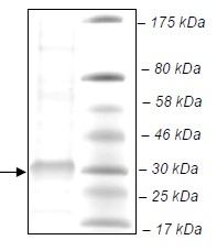 SDS-PAGE - Recombinant Human PLA2G12B protein (His tag C-Terminus) (AB135016)
