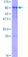 Recombinant Human Placental alkaline phosphatase (PLAP) protein