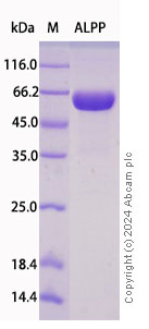 SDS-PAGE - Recombinant Human Placental alkaline phosphatase (PLAP) Protein Standard (His tag) (AB316533), expandable thumbnail