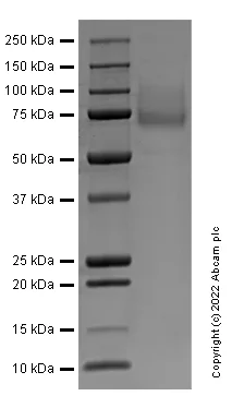 SDS-PAGE - Recombinant Human Plasma Kallikrein 1B Protein (Active) (AB307350)