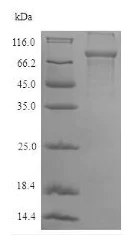 SDS-PAGE - Recombinant Human Plastin L protein (Tagged) (AB235562)