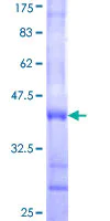 SDS-PAGE - Recombinant Human PLC-delta-3 protein (AB164992)