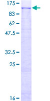 SDS-PAGE - Recombinant Human PLD2 protein (AB159137)