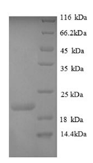 SDS-PAGE - Recombinant Human Plexin A1 protein (His tag) (AB226422)