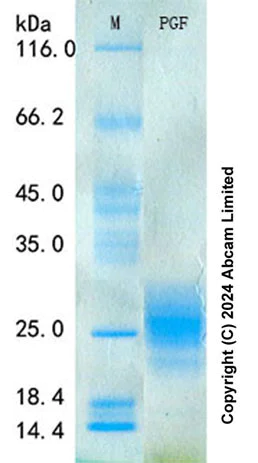 SDS-PAGE - Recombinant Human PlGF Protein Standard (His tag) (AB322087)