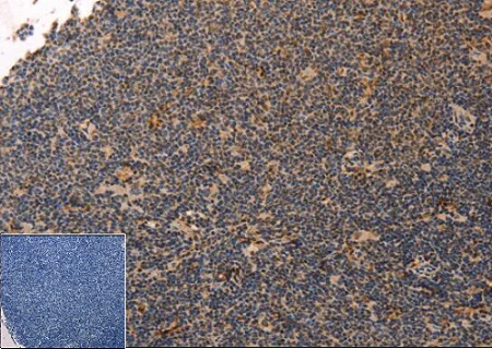 Immunohistochemistry (Formalin/PFA-fixed paraffin-embedded sections) - Recombinant human PLK1 protein (His tag N-Terminus) (AB51426)