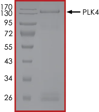 SDS-PAGE - Recombinant human PLK4 protein (AB125558)