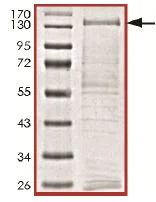 SDS-PAGE - Recombinant human PLK4 protein (AB125558)