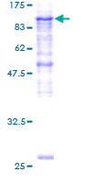 SDS-PAGE - Recombinant Human PLOD2/LH2 protein (AB116924)