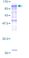 SDS-PAGE - Recombinant Human PLOD2/LH2 protein (AB116924)