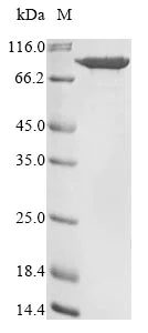 SDS-PAGE - Recombinant Human PLOD3 protein (His tag) (AB267942)