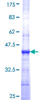 Recombinant Human PLVAP/PV-1 protein