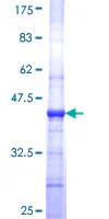SDS-PAGE - Recombinant Human PLVAP/PV-1 protein (GST tag N-Terminus) (AB153539)