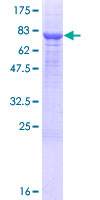 Recombinant Human PM20D1 protein