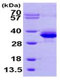 SDS-PAGE - Recombinant Human PMM1 protein (AB101111)