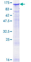 SDS-PAGE - Recombinant Human PMS2 protein (AB131836)
