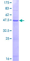 SDS-PAGE - Recombinant Human PMS2 protein (AB166543), expandable thumbnail