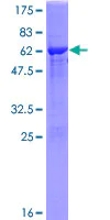 SDS-PAGE - Recombinant Human PNAD protein (AB165200)