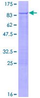 SDS-PAGE - Recombinant Human PNK/PNKP protein (AB131925), expandable thumbnail