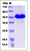 SDS-PAGE - Recombinant Human PNLIPRP1 protein (His tag) (AB276561)