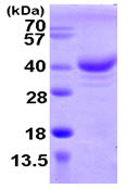 SDS-PAGE - Recombinant Human pNO40 protein (AB104634)